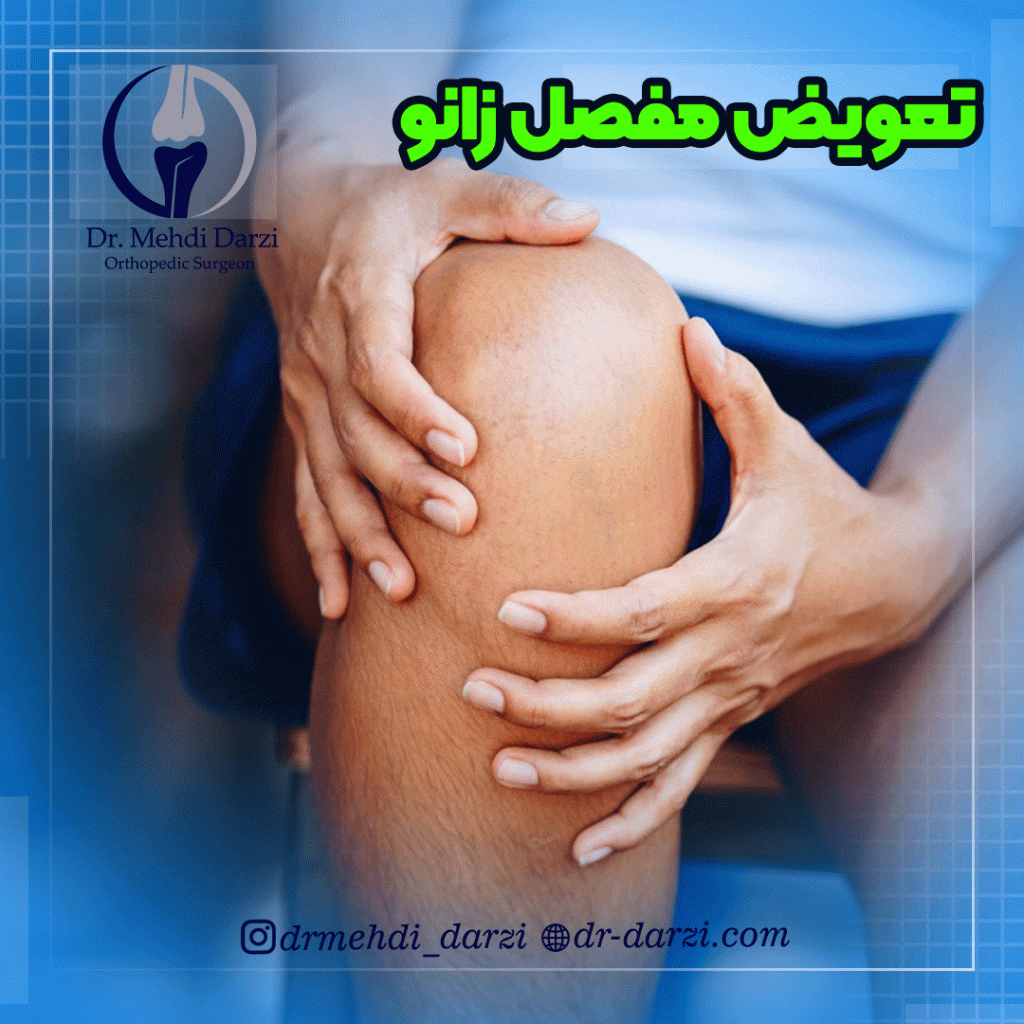 تعویض مفصل زانو