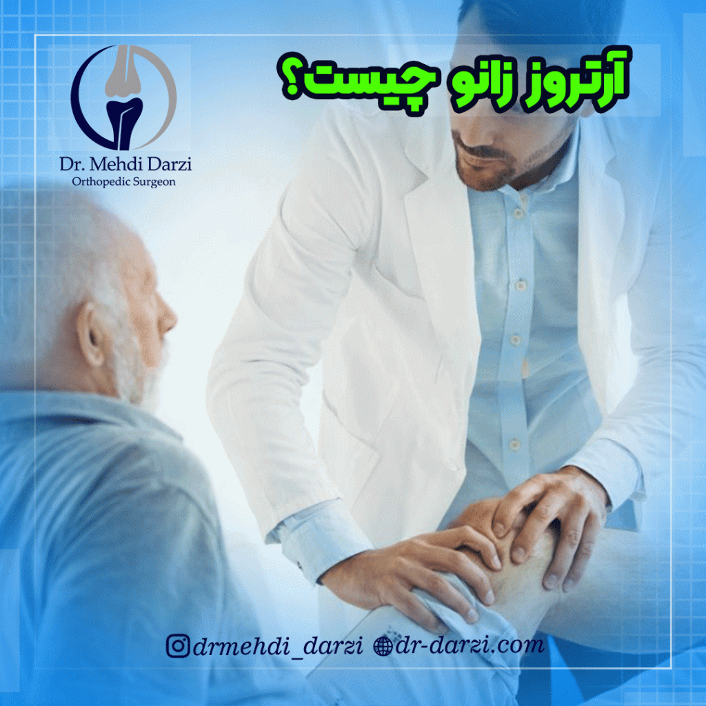 ارتروز زانو چیست؟