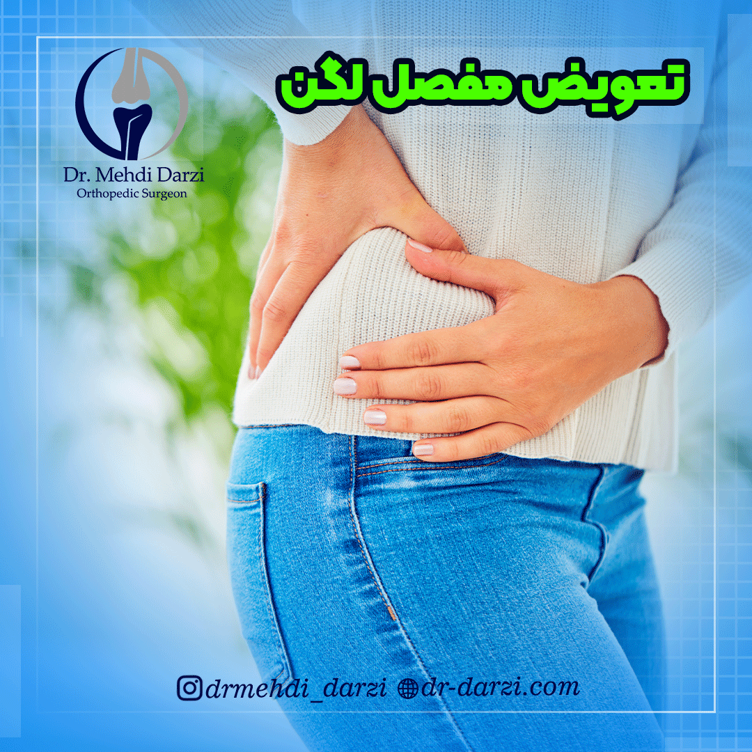 تعویض مفصل لگن