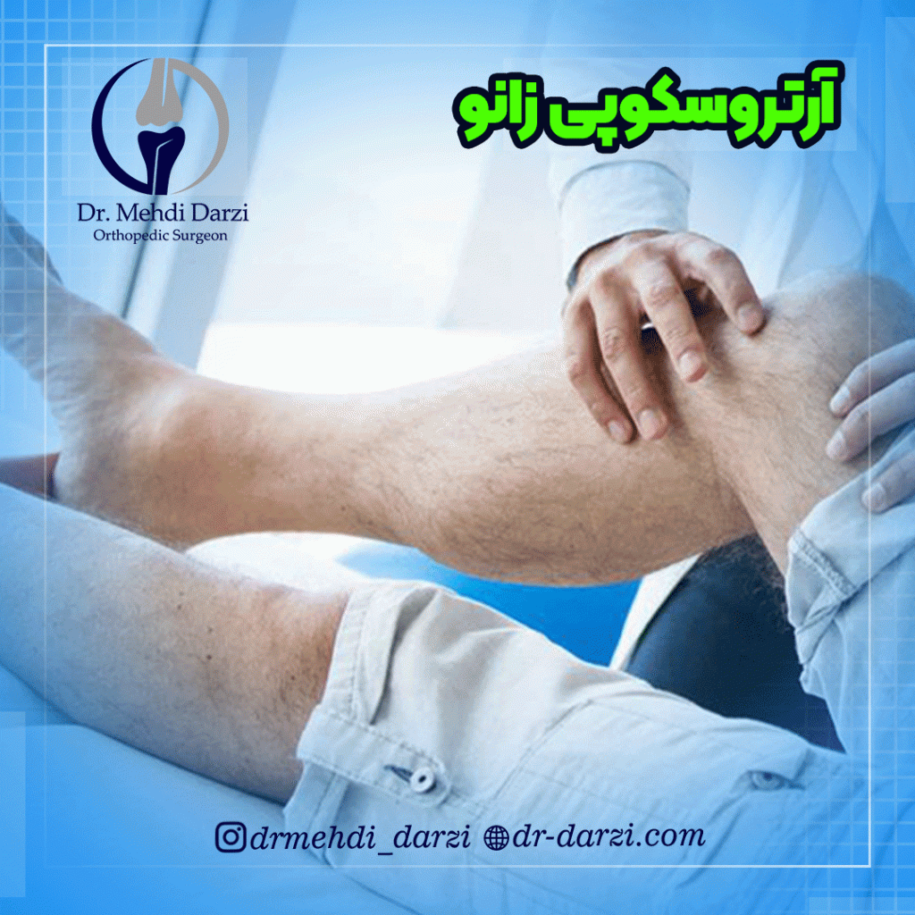 آرتروسکوپی زانو