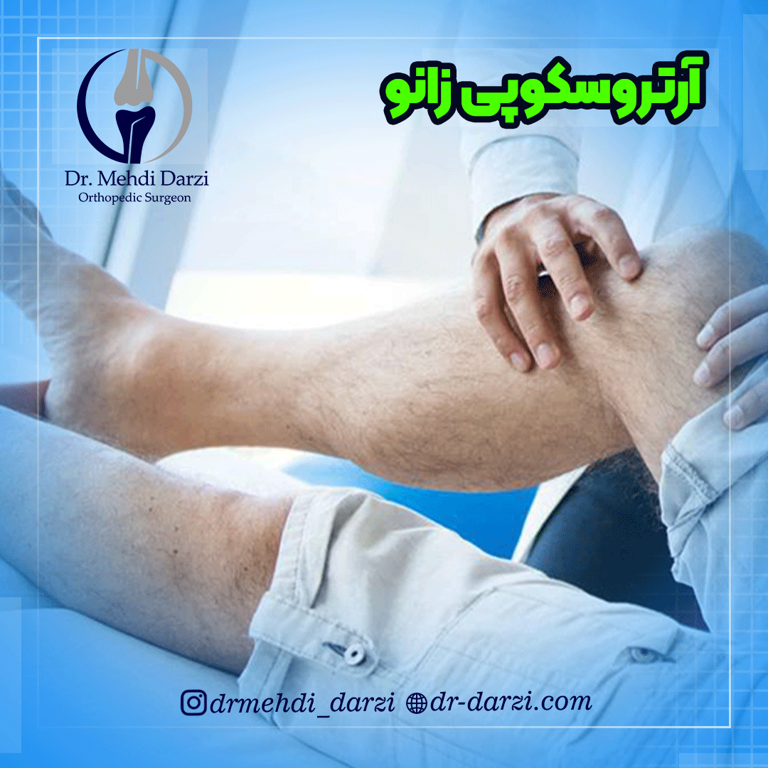 آرتروسکوپی زانو