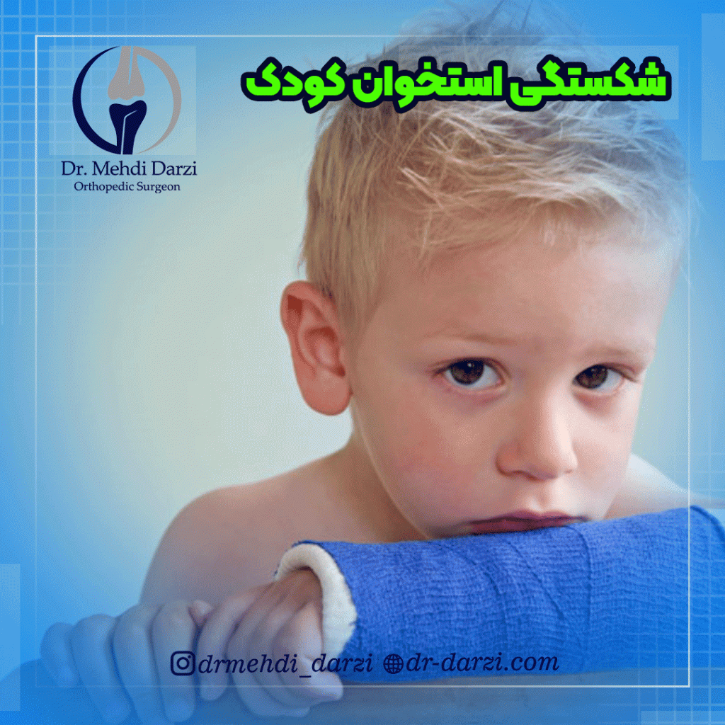 شکستگی استخوان کودک
