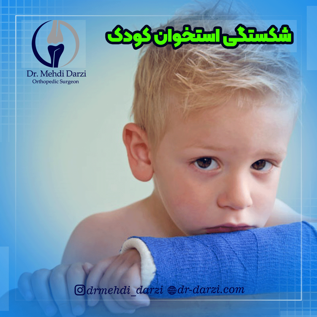 شکستگی استخوان کودک