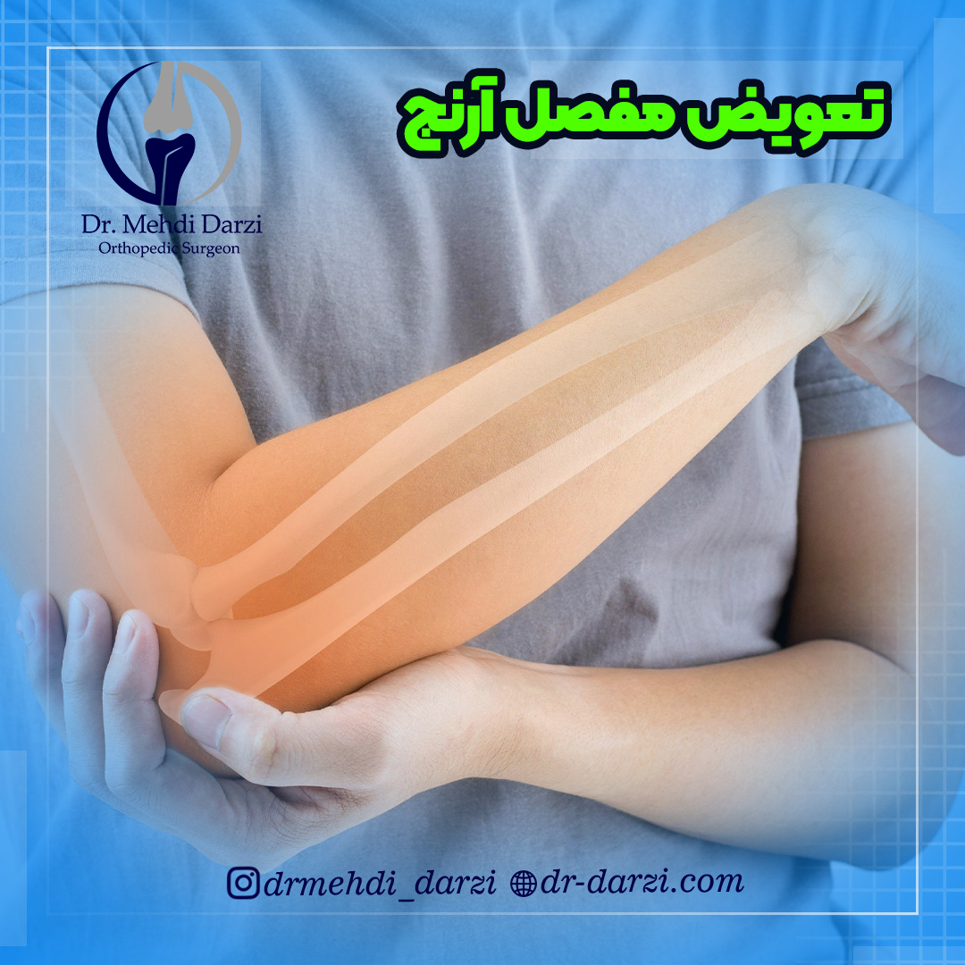 جراحی تعویض مفصل آرنج