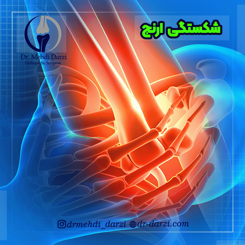 شکستگی آرنج