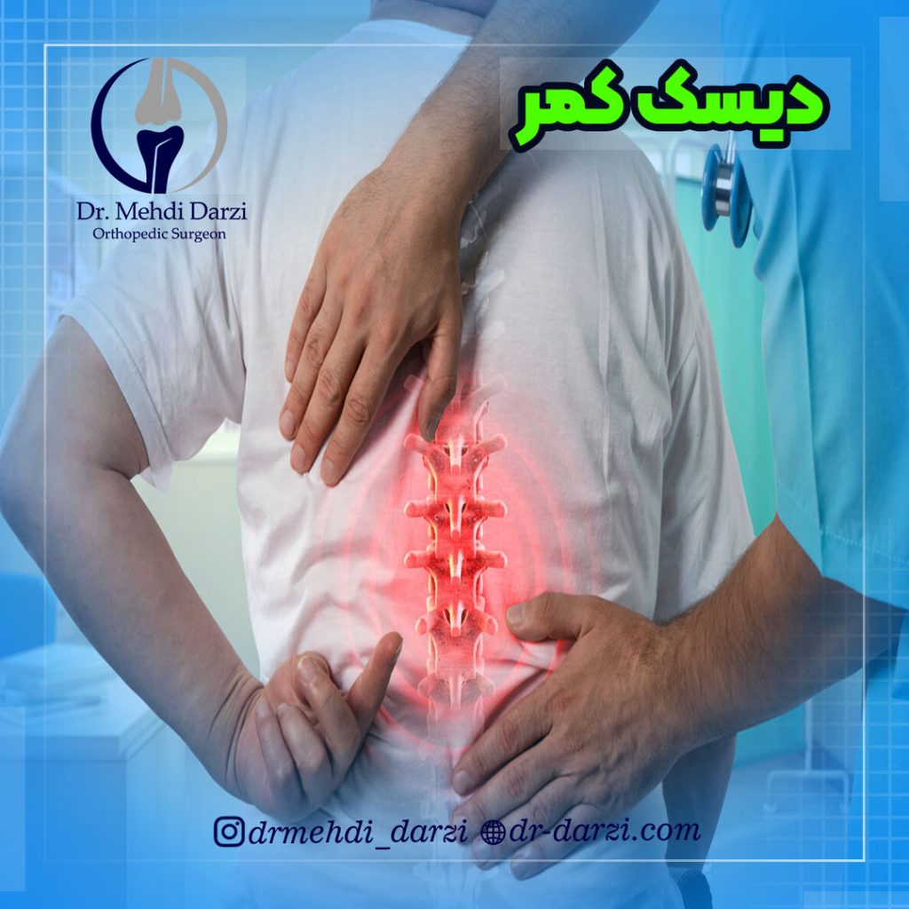دیسک کمر یا (herniated disk) چیست؟