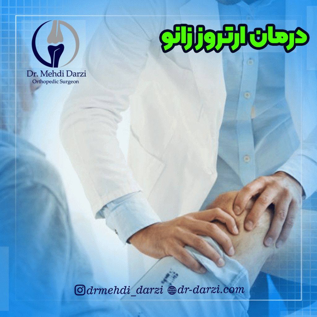 درمان ارتروز زانو