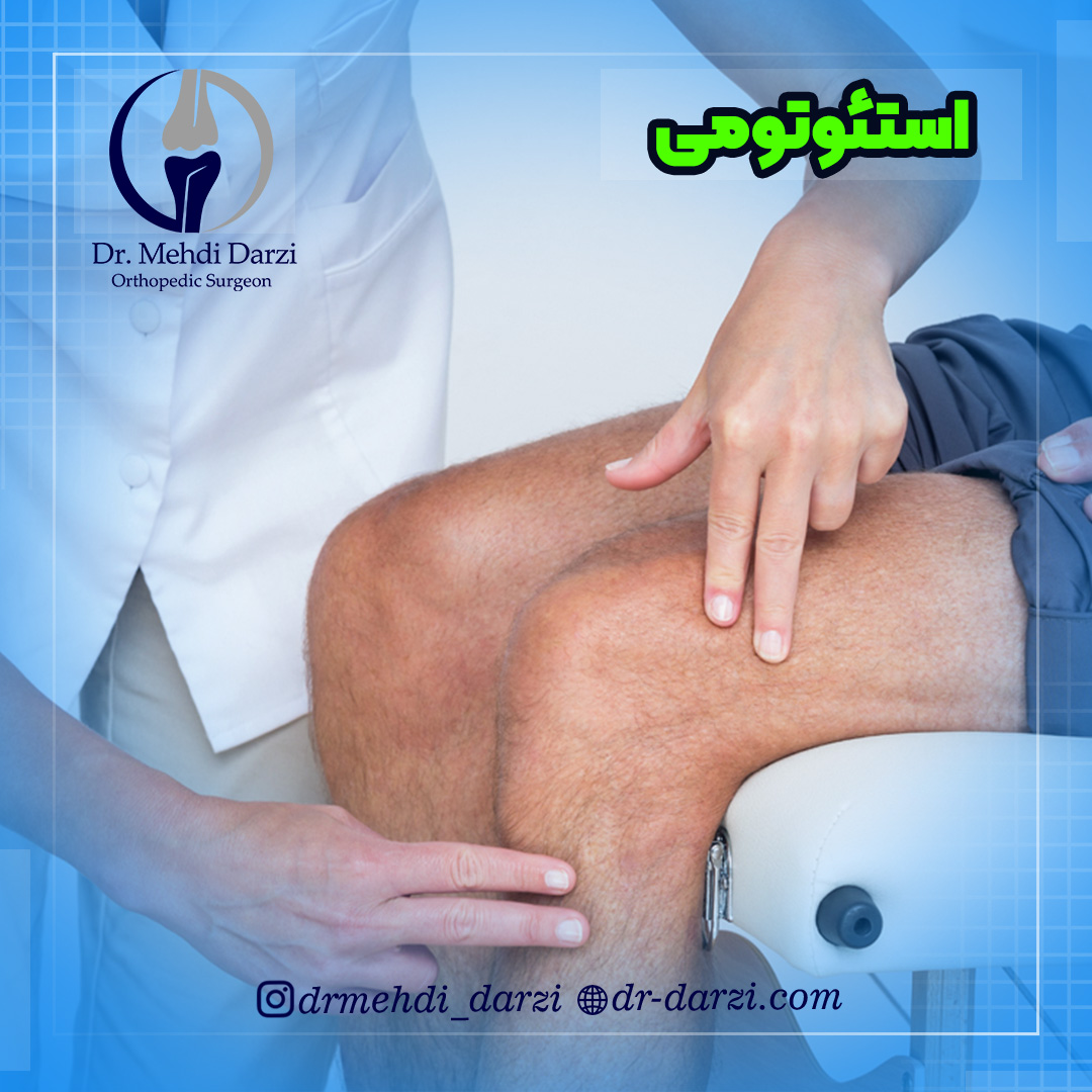 جراحی استئوتومی زانو