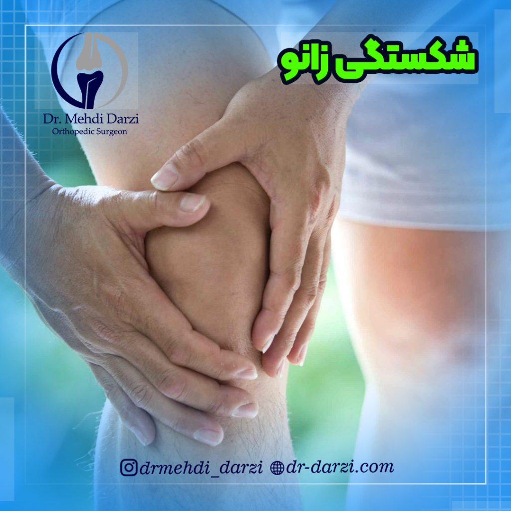 شکستگی زانو