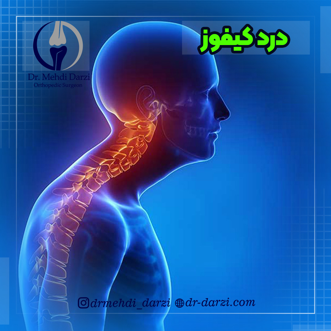 درد کیفوز (قوز کمر)