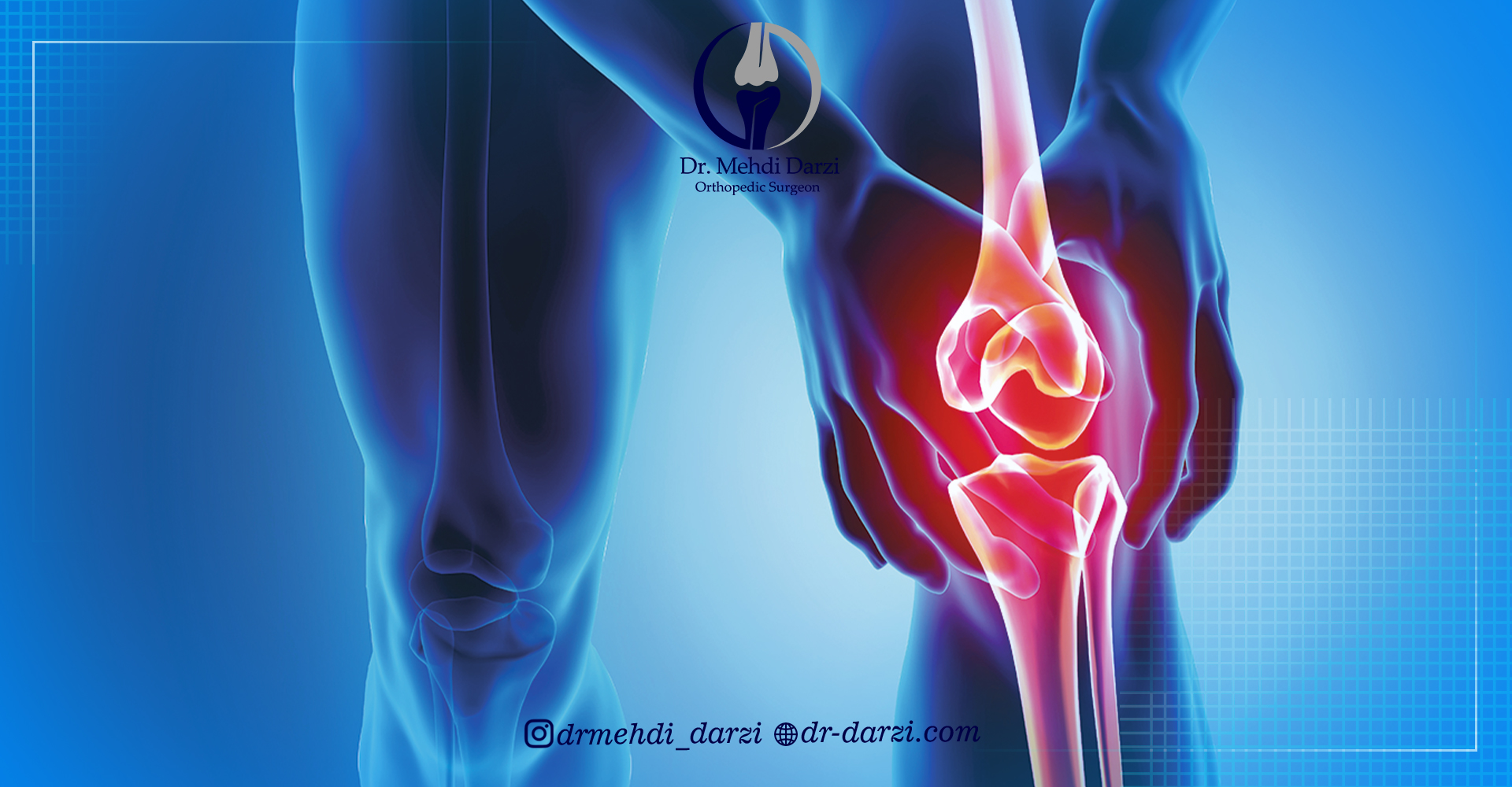 روش های پیشگیری از نیاز به جراحی مجدد زانو