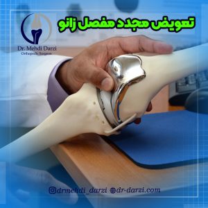 جراحی مجدد تعویض مفصل زانو