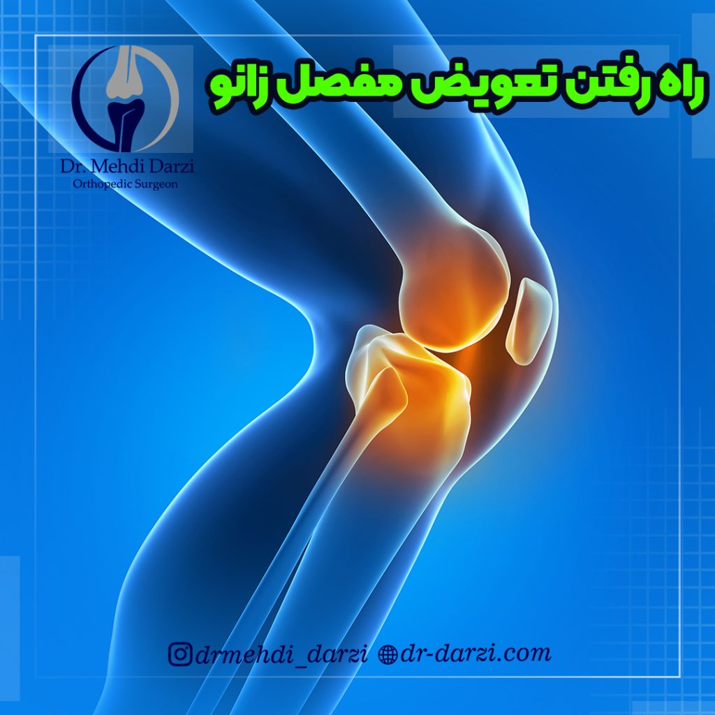 راه رفتن بعد از تعویض مفصل زانو