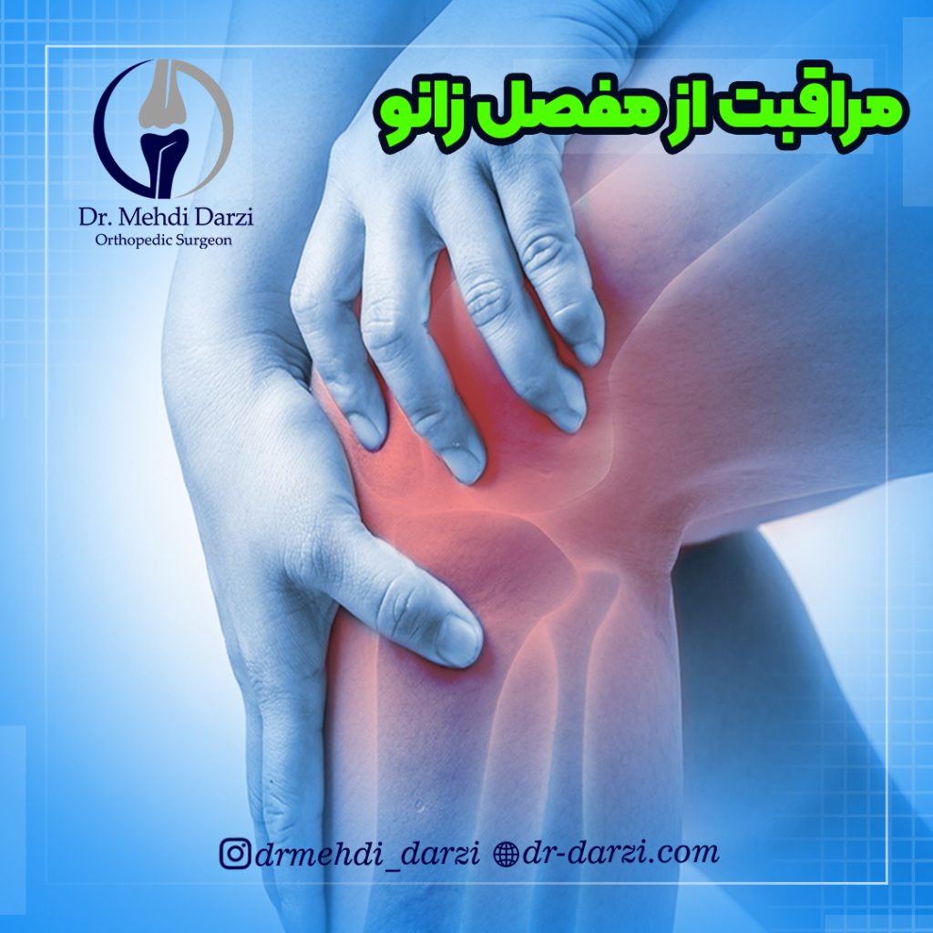مراقبت از مفصل زانو