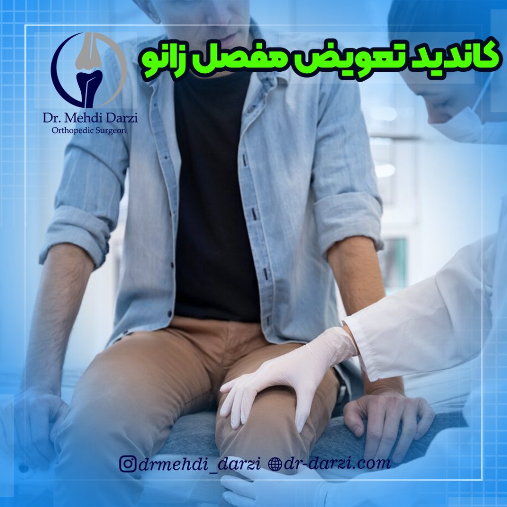 افراد کاندید جراحی مفصل زانو