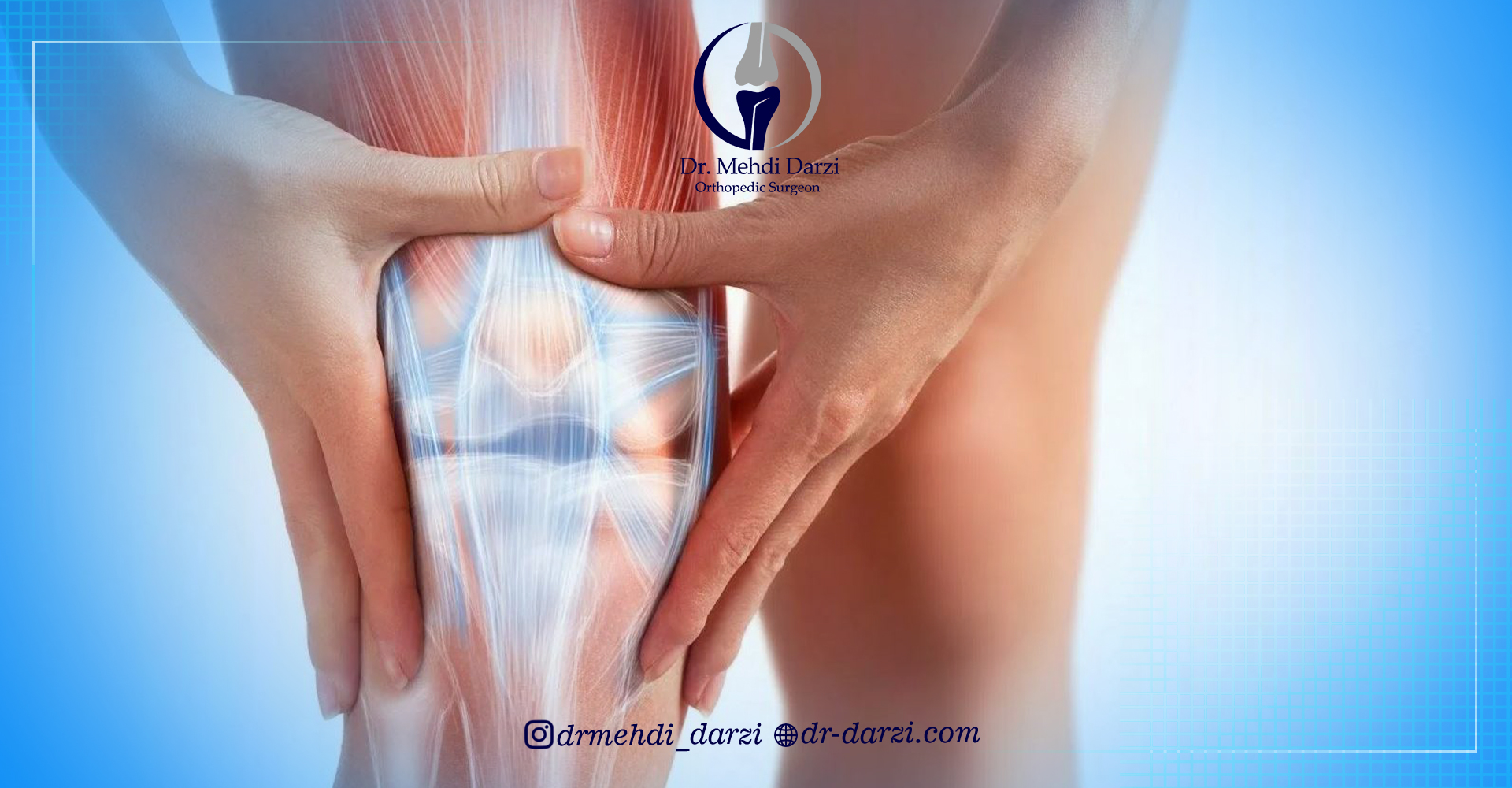 پارگی تاندون زانو چیست؟
