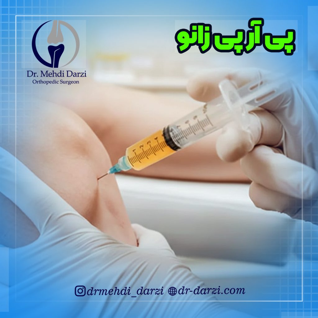 پی آر پی زانو