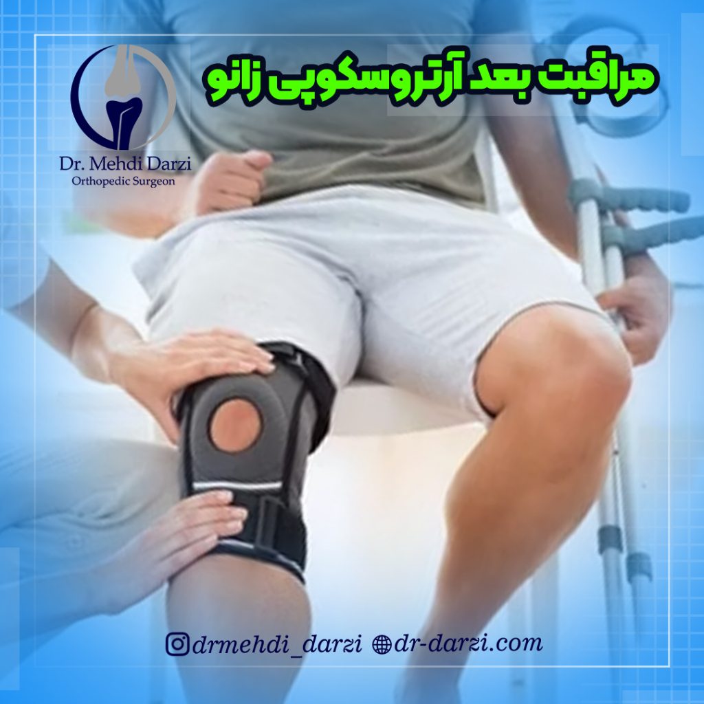 مراقبت های بعد از آرتروسکوپی زانو